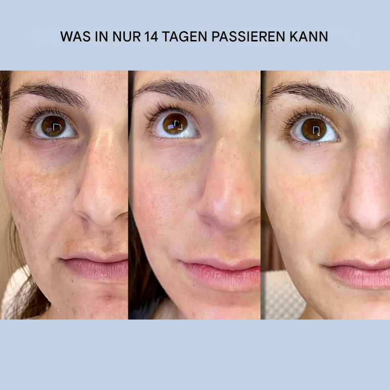 Lifting Gesichtsstreifen | Sofort Glätten & Straffen | Anti-Falten Pflege ohne OP | YouthLift Renew