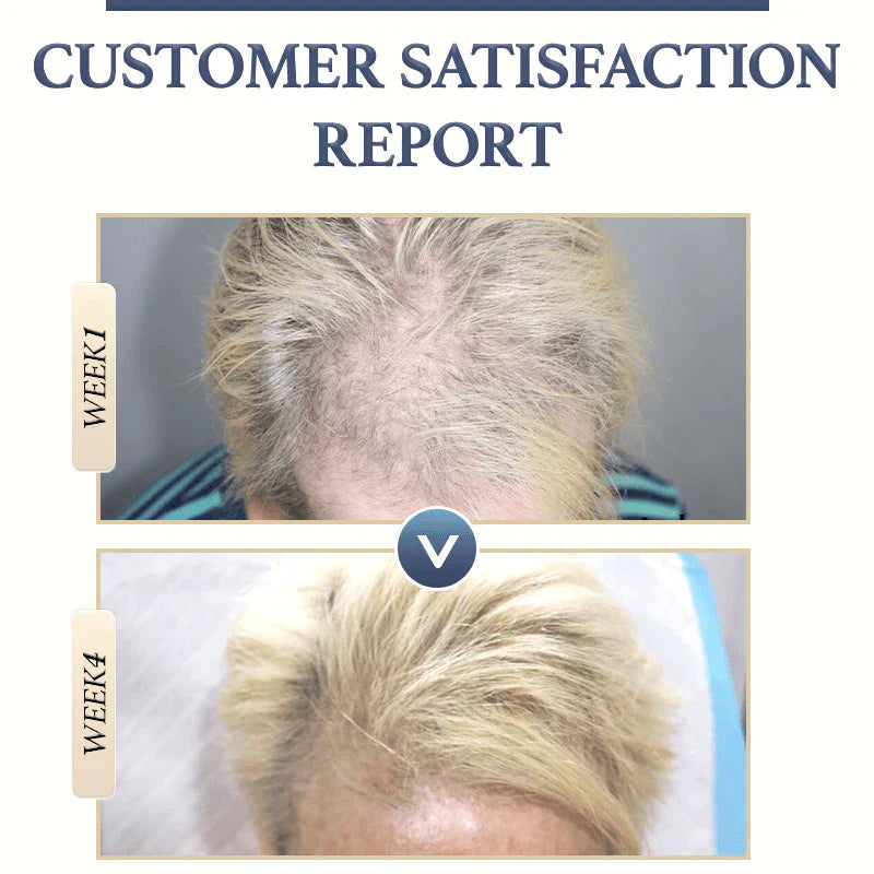 Natürliches Haarwachstum Shampoo | Weniger Haarausfall | Sanfte Kopfhautpflege | RiceBloom