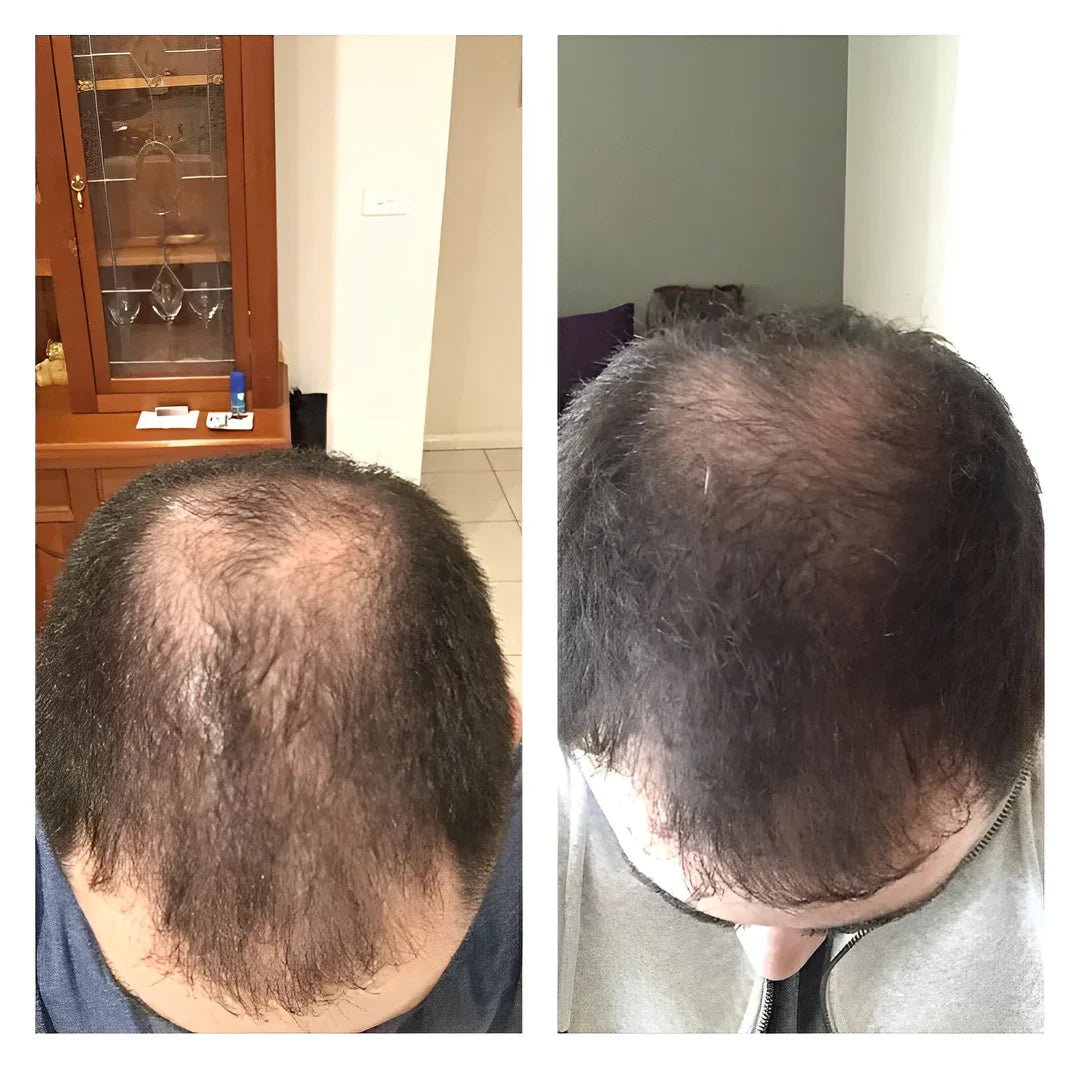 Natürliches Haarwachstum Shampoo | Weniger Haarausfall | Sanfte Kopfhautpflege | RiceBloom